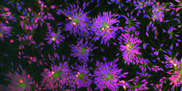 Brain stem cell image